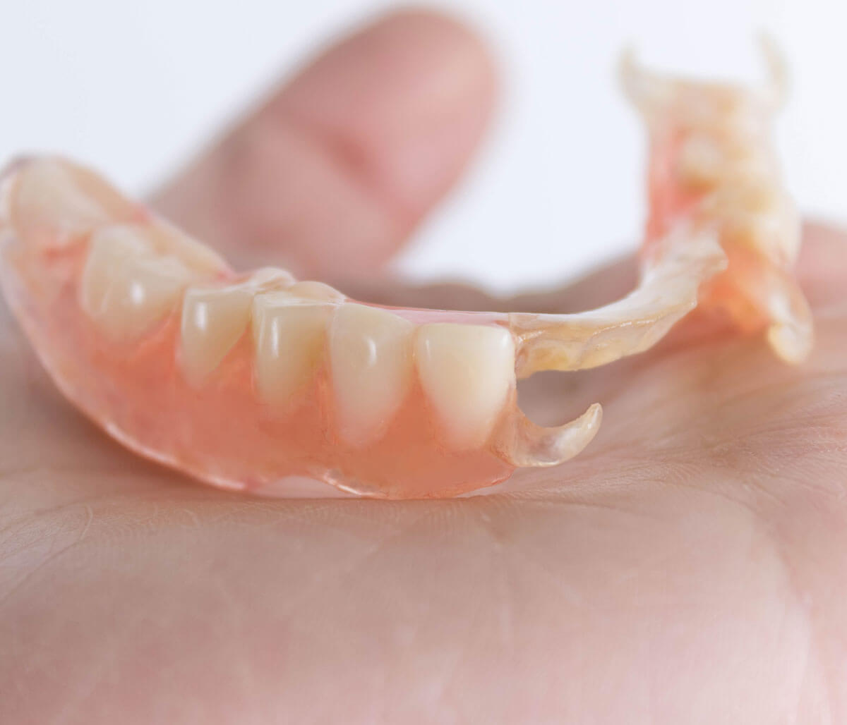 Bloomington patients restore their smiles with versatile dental crowns
