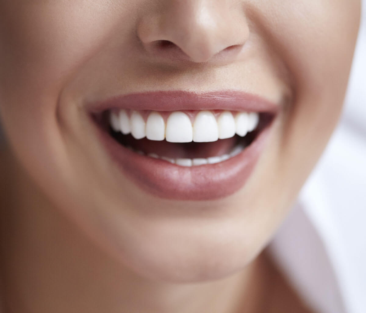 Bloomington, IL patients smile brighter with Zoom! Teeth whitening
