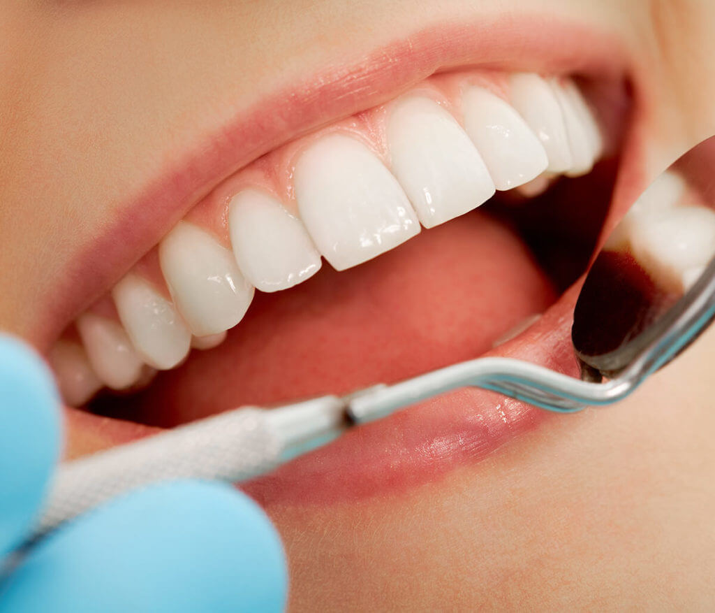 In Bloomington, IL Area, Dentist Explains the Importance of Regular Dental Cleanings