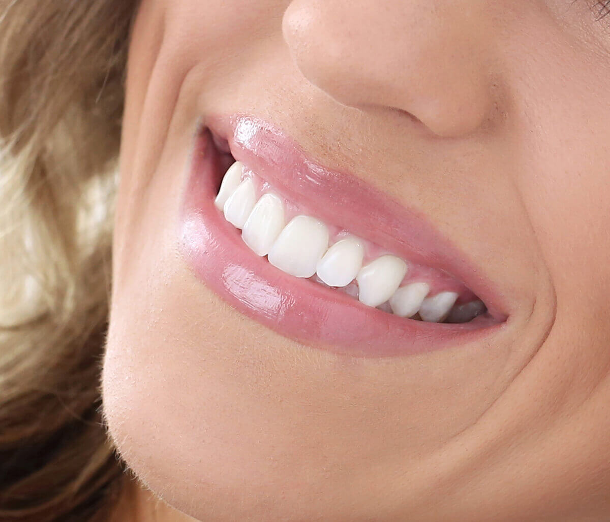 Effective Teeth Whitening System at Eastland Dental Center located in Bloomington, IL Area